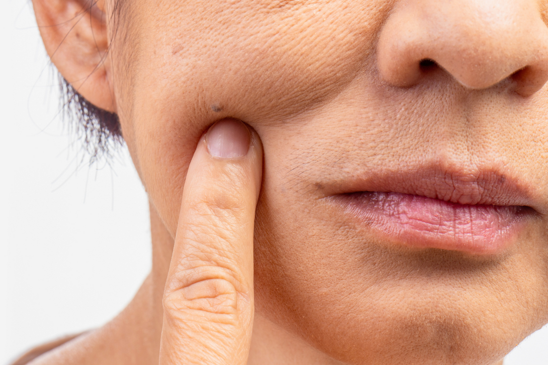 Managing Dry Mouth in the Elderly: Causes, Effects on Swallowing, and Tips for Relief